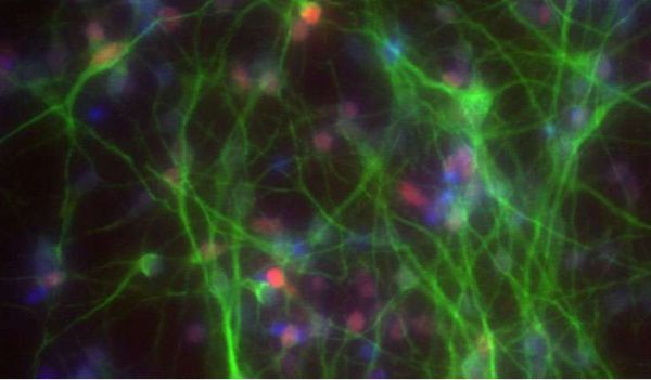 科學家利用CRISPR-Cas9技術(shù)成功構(gòu)建出細胞疾病模型