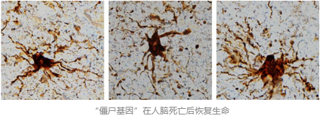“僵尸基因”在人腦死亡后恢復生命