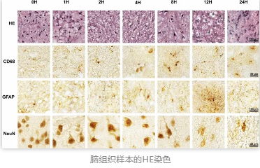 腦組織樣本的HE染色