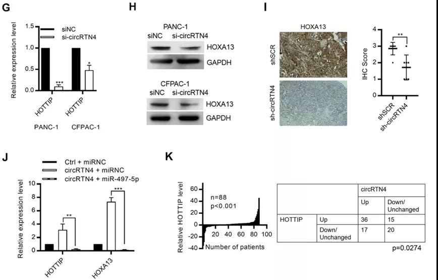 circRTN4通過在PDAC中“吸附”miR-497-5p來促進HOTTIP的表達(圖源: Molecular Cancer) circRTN4通過在PDAC中“吸附”miR-497-5p來促進HOTTIP的表達(圖源: Molecular Cancer)