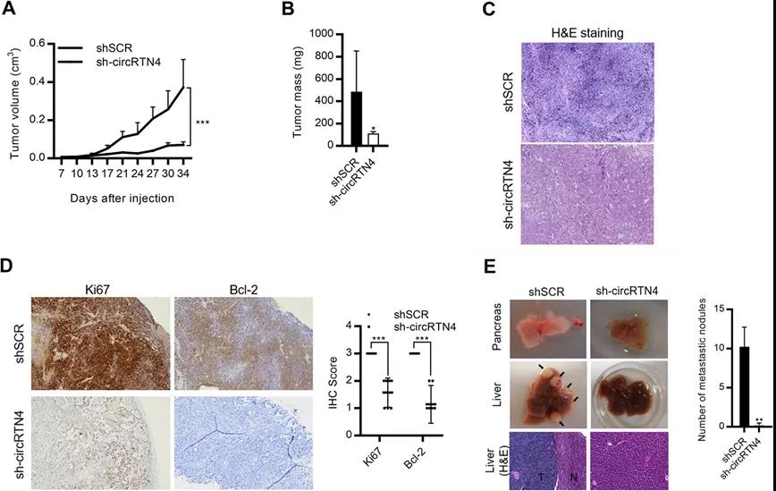 circRTN4促進PDAC腫瘤生長和肝轉移(圖源: Molecular Cancer) circRTN4促進PDAC腫瘤生長和肝轉移(圖源: Molecular Cancer)