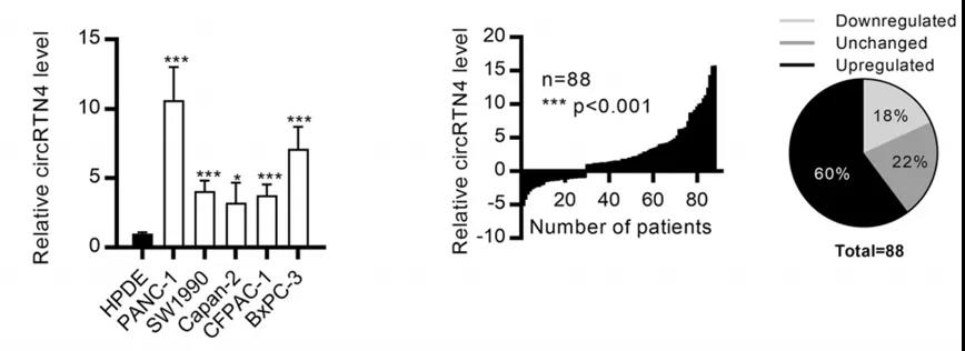circRTN4在PDAC細胞和原發性腫瘤中上調(圖源: Molecular Cancer) circRTN4在PDAC細胞和原發性腫瘤中上調(圖源: Molecular Cancer)