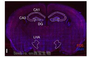 Nature：科學家發現記憶如何控制新陳代謝