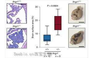 干擾素-r（IFNr）調(diào)控軟腦膜抗腫瘤免疫應(yīng)答的機(jī)制研究
