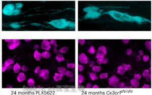 《Nature Neuroscience》大腦白質為何隨年齡退化？因為免疫細胞“勾心斗角”